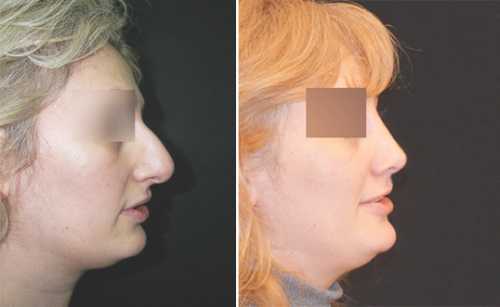 В соответствии с ним запрещены хвостики, маллеты тип прически, в котором волосы подстрижены коротко спереди и по бокам, а сзади остаются длинными и волосы с укладкой шипами