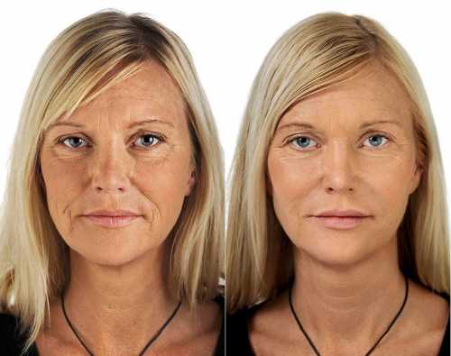 И её нельзя решить за один день даже с помощью чудокрема