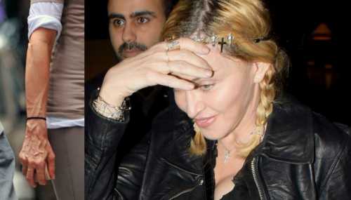 Секрет вечной молодости Мадонны – в правильных процедурах