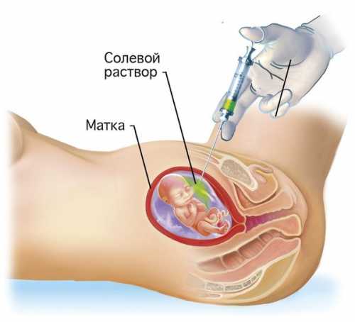 Перед тем, как начать процедуру, гинекологу нужно назначить анализы