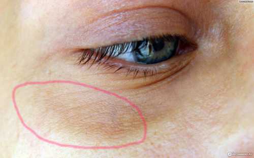 Его нужно разрезать на довольно тонкие кольца и разместить на кожу век