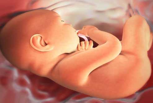 Говорили про кислородную недостаточность, как раз была зима и холодная весна